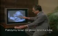 Tak wygląda aborcja...osoby delikatne