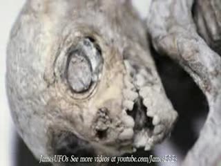 UFO Alien Metepec Mexico Medical Analisys