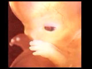stop aborcji 2