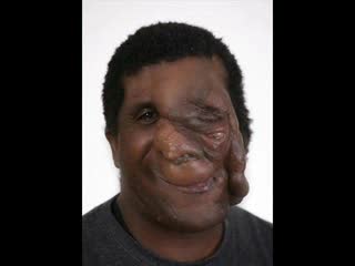 Deformacje ciała