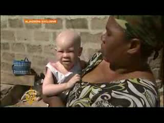 Tanzania albinos face violence - 25 Jun 08