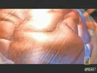 Anatomia uderzenia