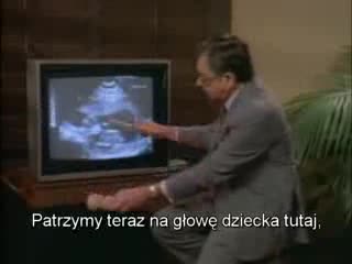 Tak wygląda aborcja...osoby delikatne